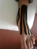 Kineziotaping